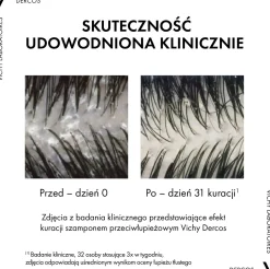 Anti-Schuppen Pflegeshampoo für trockenes Haar