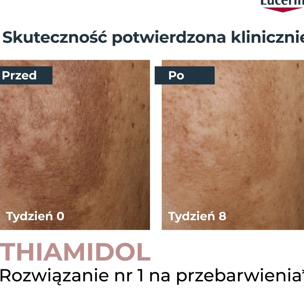 Gesichtsconcealer gegen Pigmentflecken