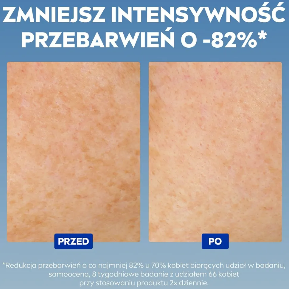 Gesichtsserum gegen Pigmentflecken