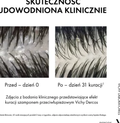 2in1 Anti-Schuppen Shampoo-Conditioner für alle Haartypen und gereizte Kopfhaut