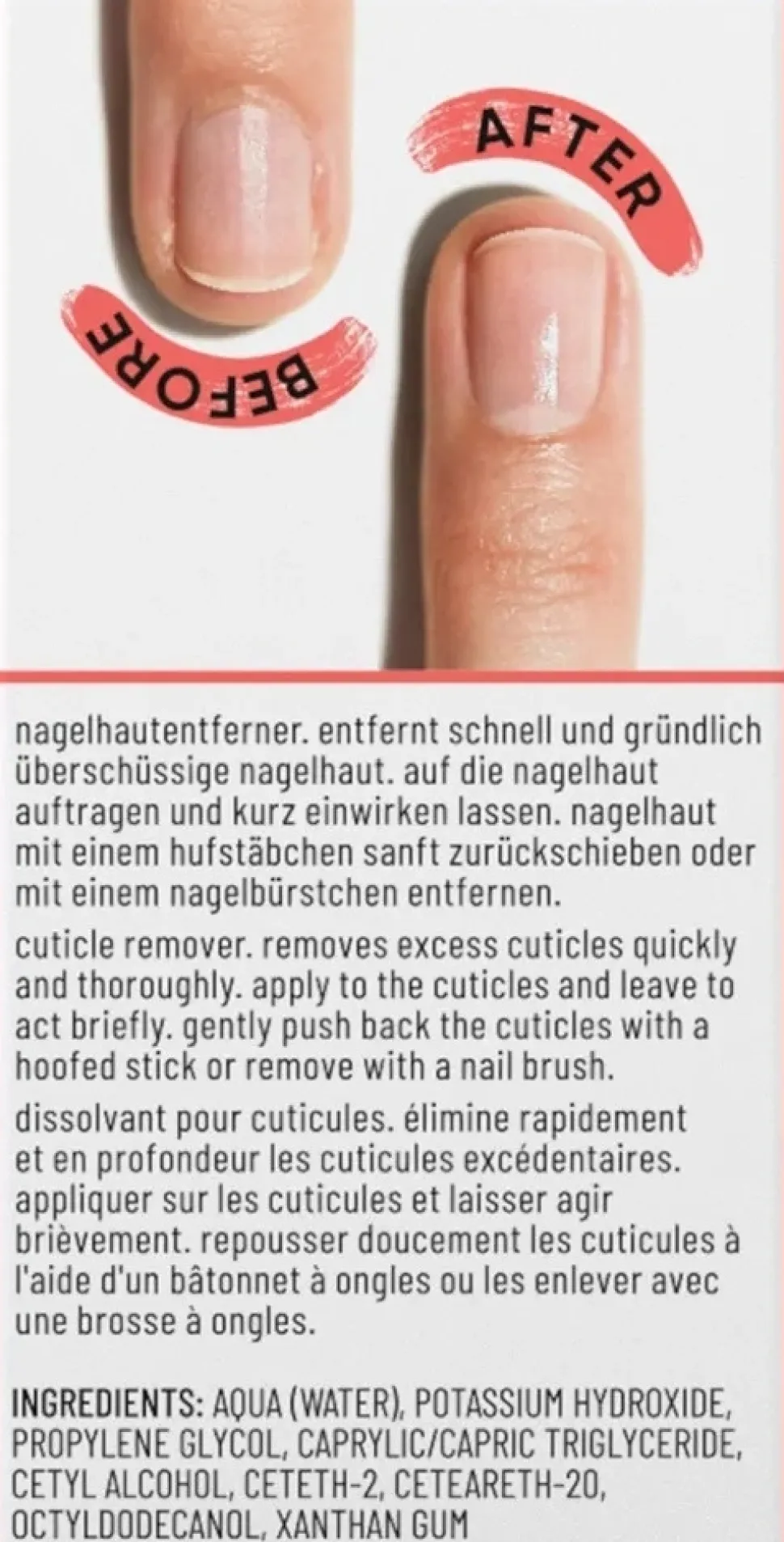 Nagelhautentferner