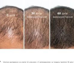 Natürliches Klettenöl gegen Haarausfall und zum Wachstum