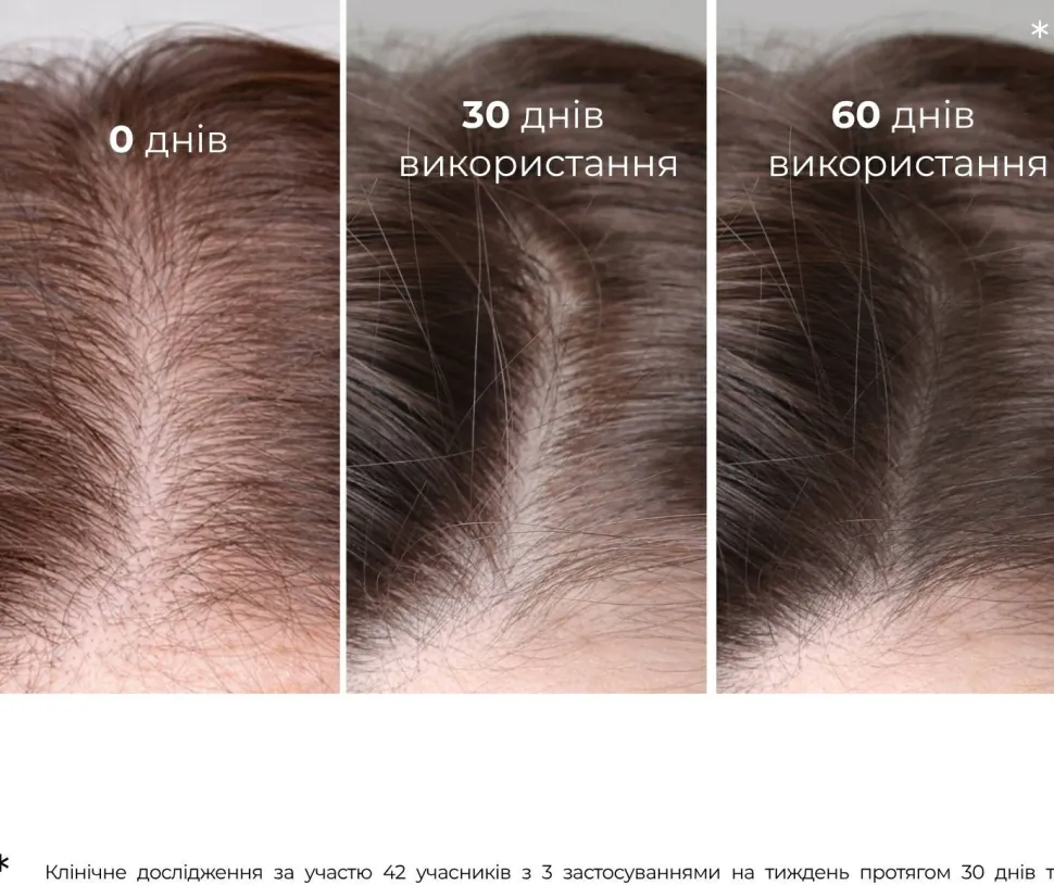 Serum mit Klette gegen Haarausfall und zum Wachstum