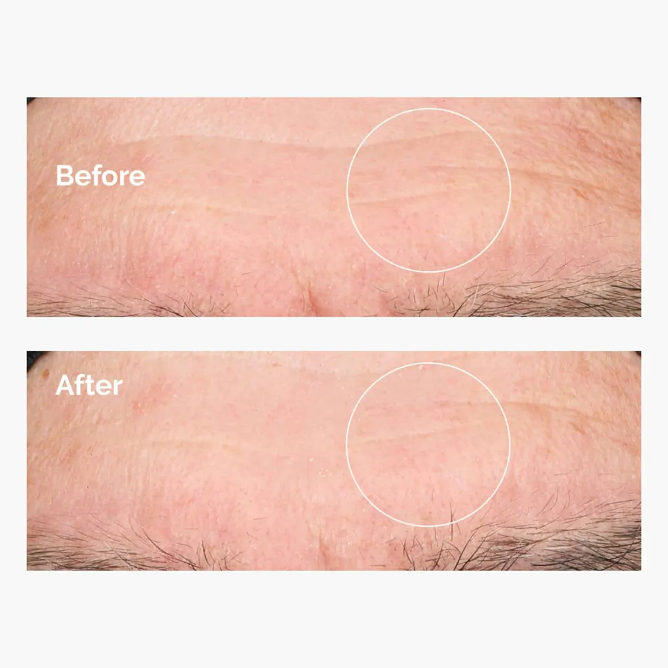 The Ordinary Hyaluronic Acid 2%