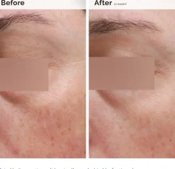 The Ordinary Niacinamide 5% Face & Body Emulsion